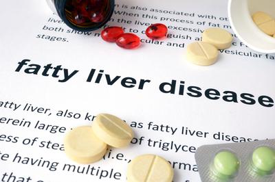 fatty liver, NAFLD, liver detox