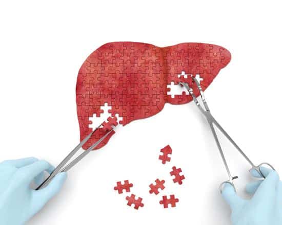 NAFLD fatty liver