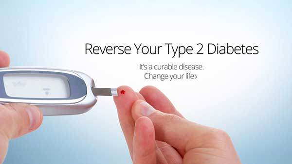 Type 2 diabetes